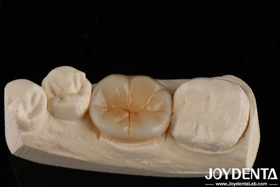 800 MPa Resistência flexural e 8 MPa·m1/2 Resistência à fractura em zircônio multicamadas para aplicações de resistência