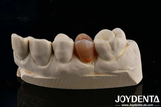 Biocompativel e de aparência natural, de zircônio com estética