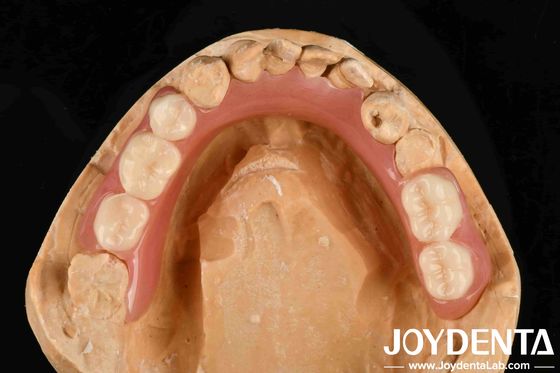 Personalização Dentária Acrílica Finish Boa Elasticidade E Propriedade Leve Para Performance Prótese Melhorada