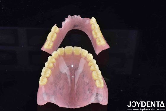 Tecnologia avançada de arranjo dentário Prótese dentária acrílica com boa elasticidade e características diversas