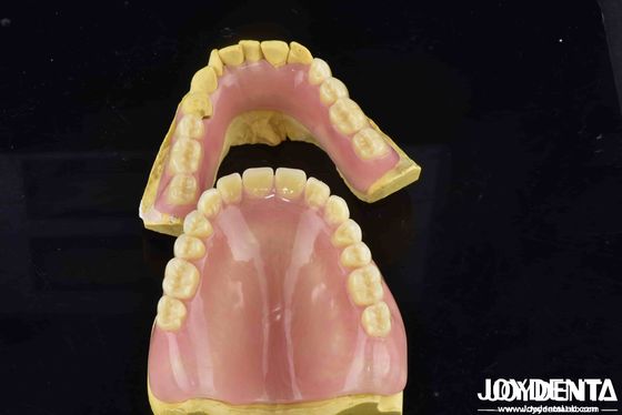 Desbloqueie o potencial da sua prática odontológica Prótese dentária acrílica com propriedades diversas e leves