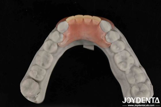 Leve a sua prática odontológica para o próximo nível Dentes flexíveis com morfologia dentária natural e personalização personalizada