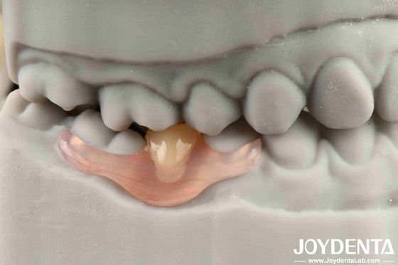Flexível Denture Finish Personalização personalizada e tecnologia avançada de arranjo dentário para necessidades personalizadas