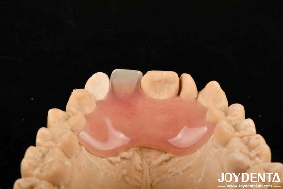 Alto sigilo Boa elasticidade Flexível acabamento de dentadura para diversos processos de fabricação
