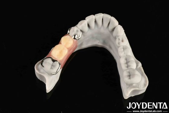 Estrutura oral estável para profissionais dentistas em firmemente conectar a linha de dentes