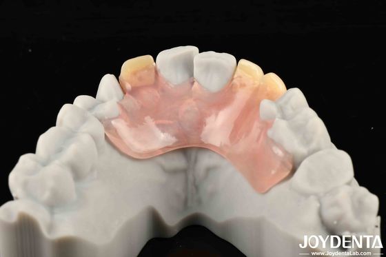 Estrutura oral estável Estrutura de efeito Configuração de dentes Finish Design de aparência bonita e harmoniosa