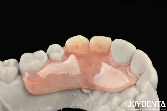 Beleza e harmonia na aparência Estrutura de design Configuração de dentes Finish Tecnologia elaborada para estrutura oral estável