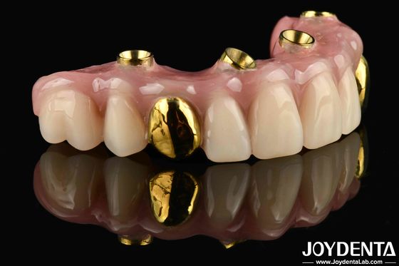 50 ml Dentwre dos Estados Unidos Sua solução definitiva Ti-Bar acabamento de dentes acrílico para tratamento dentário