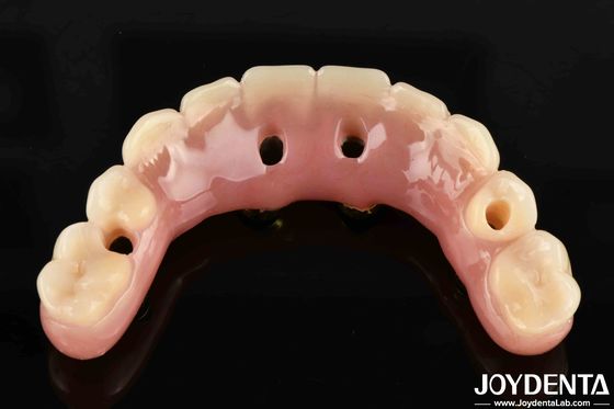 50 ml Ti-Bar Dentals Acrylic Finish 24 Horas Curing Time Estados Unidos Para Dentistas Profissionais