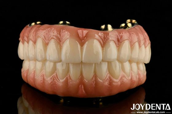 Dentes e gengivas naturais compatíveis Ti-Bar Zirconia ponte híbrida com alta biocompatibilidade