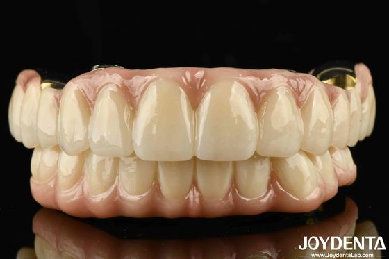 Excelente força Ti-Bar Zirconia ponte híbrida para dentes naturais e compatibilidade gengivas