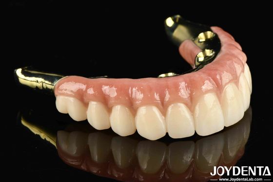 Diga adeus aos dentes perdidos com zircônio natural e durável