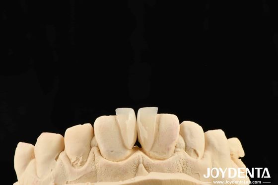 Alta Durabilidade Micro Veneer 0.2mm espessura e desempenho confiável