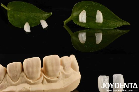 Alta Durabilidade Micro Veneer Ultrafinho Com Madeira Natural 0.2mm Espessura