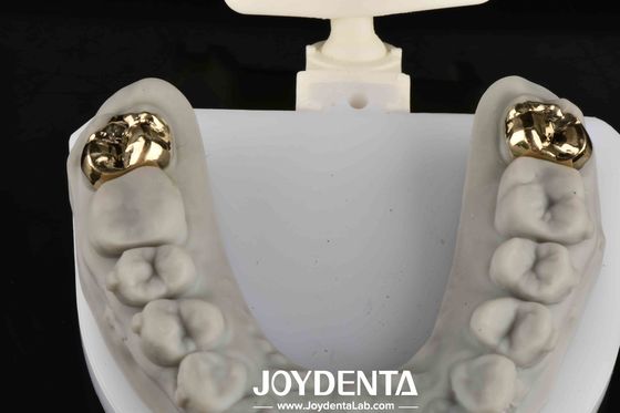 Reabilitação Oral com Dentista: Sorriso Mais Brilhante e Saudável
