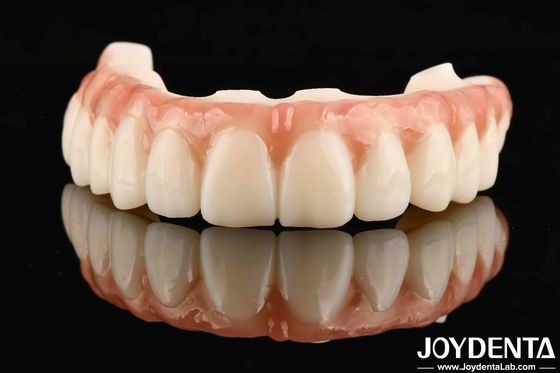 Superfície resistente a arranhões para restaurações dentárias duradouras M75 Restaurações duradouras