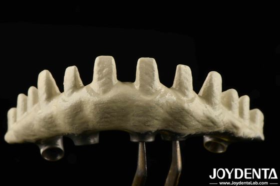 Tipo de conexão hexadecimal interna Abutments de implantes personalizados em areia e gravados com ácido para um ajuste superior