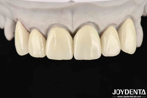 6.0-6.1 G/cm3 Densidade de zircônio em camadas para alta translucidez na fresagem CAD / CAM