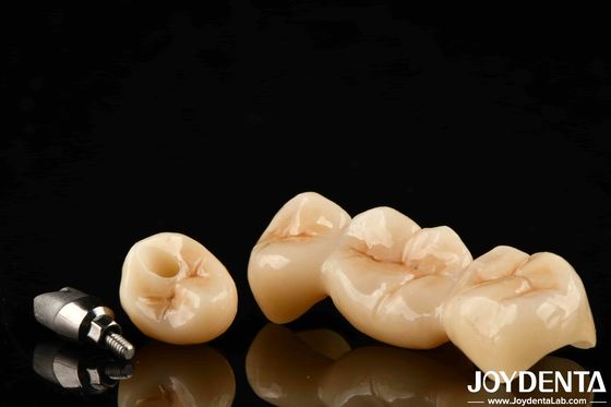 Multicamadas de zircônio de alta resistência a rachaduras e durabilidade para restaurações dentárias duradouras