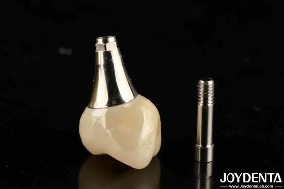 Implante dentário biocompativel coroa e ponte esteticamente agradável para oral seguro