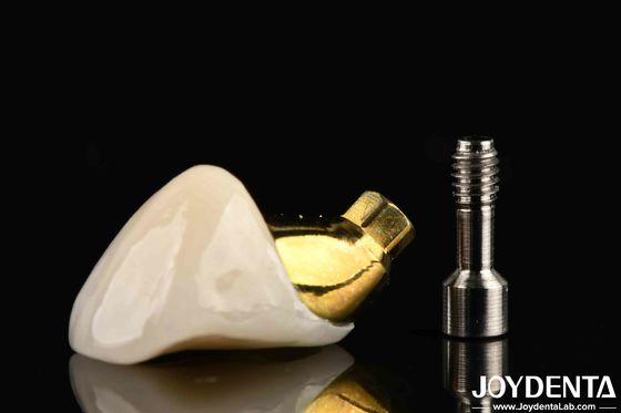 Coroa e ponte de implantes de longa duração para restaurar dentes perdidos adequados para implantes dentários