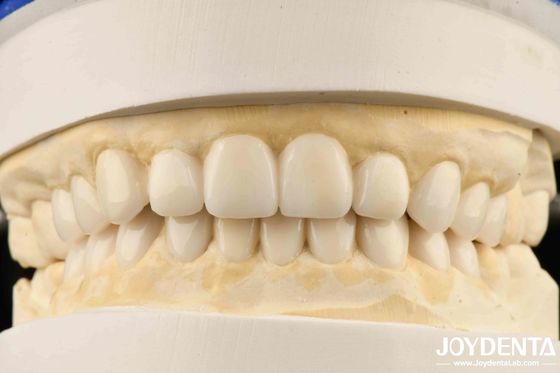 Aplicações dentárias Biomiméticas Diagnóstico Estético