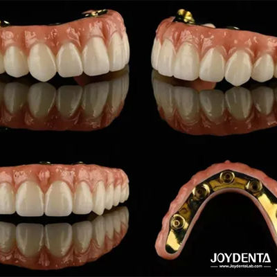 Ti Bar Zirconia Hybrid Implant Bridges Alta Translucidez Para Prótese Dental