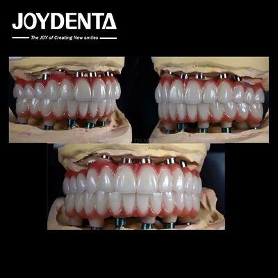 Implante de Dentes Múltiplos de Titânio de 10 mm Superfície áspera para restauração dental