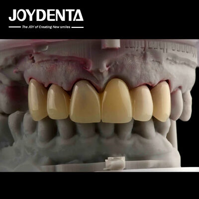 CAD CAM Processamento Dental PMMA Material Multilayer Design Para Transições de Sombra Natural