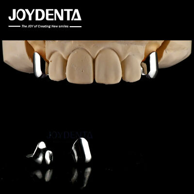 Prótese removível de precisão Aplicativos de implantes dentários Facil limpo Confortável