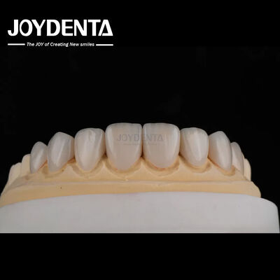 Veneers cerâmicos de vidro de aparência real com acabamento de superfície brilhante ou fosco