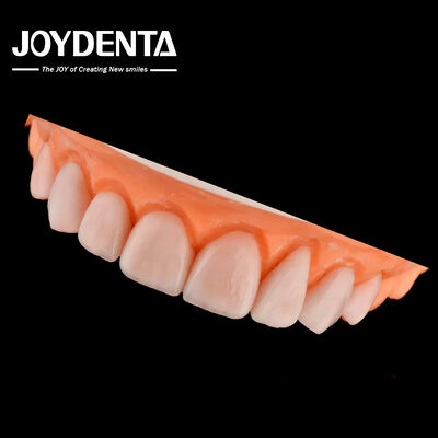Fabricação sob medida IPS Porcelana Emax Veneers Restaurações dentárias Resistente a chipping