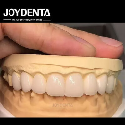 16 tons de cor Emax Veneers Dentários A1-A4 Alta resistência a manchas para sorrisos perfeitos