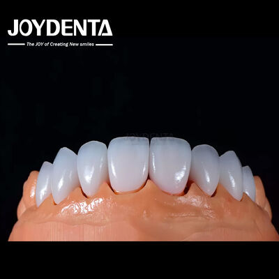 A1-A4 Ips Emax Prensa de porcelana Folheados dentários resistentes a manchas Forma personalizável