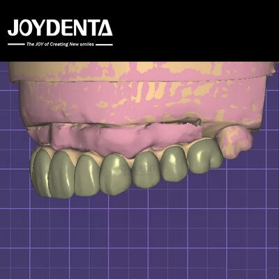 Segurança de dados compatível com a HIPAA Modelo 3D de cera digital para modificações dentárias